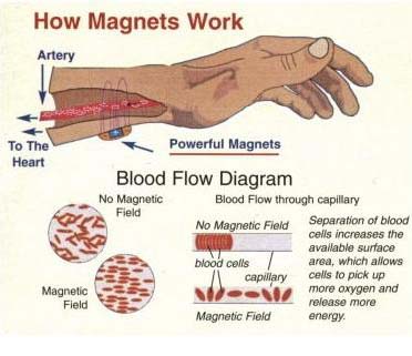 MagnetoTherapy  
